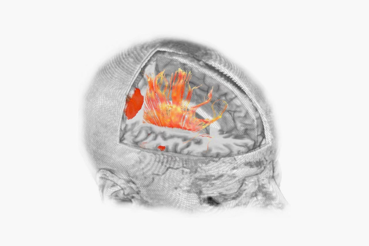 features-brainwave-imaging-software-desktop