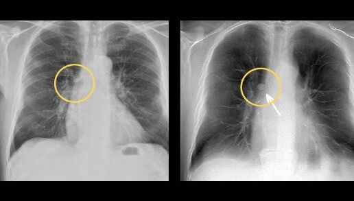 features-card-half-volumerad-ci-en