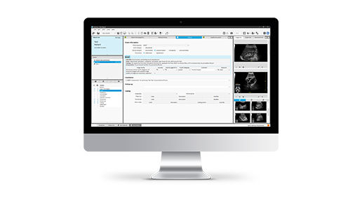 features-card-half-workflow-desktop-516x290
