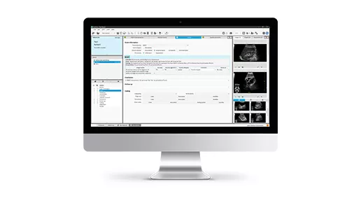 features-card-half-workflow-desktop-516x290