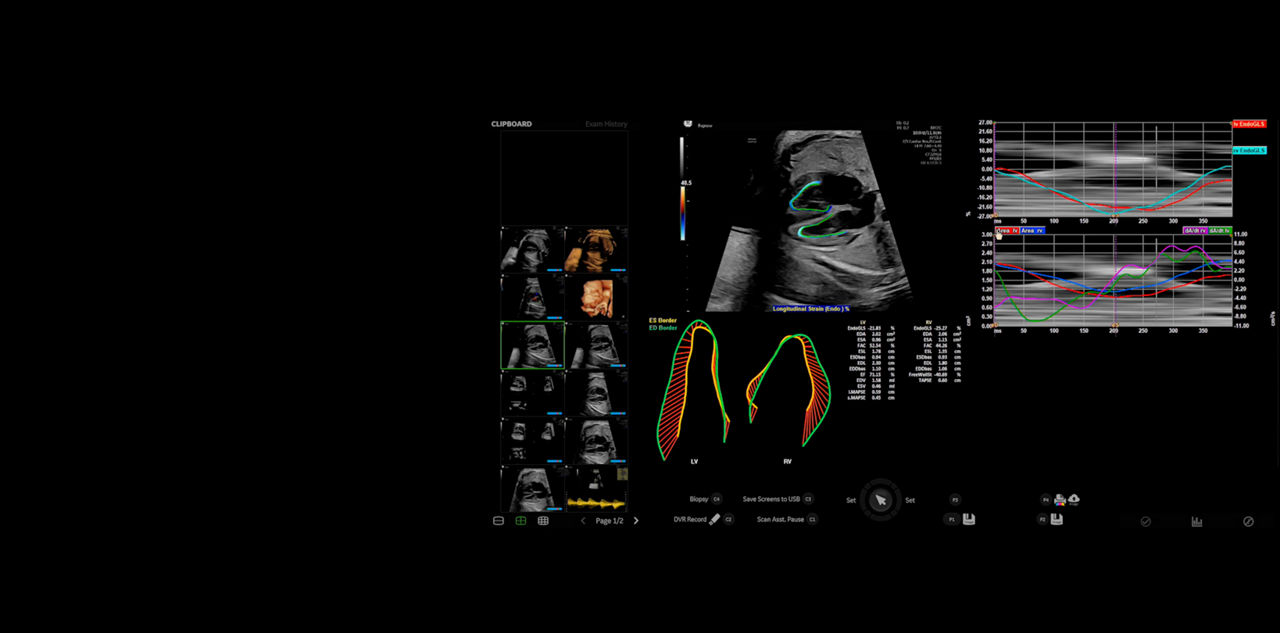 Fetal Heart Monitoring