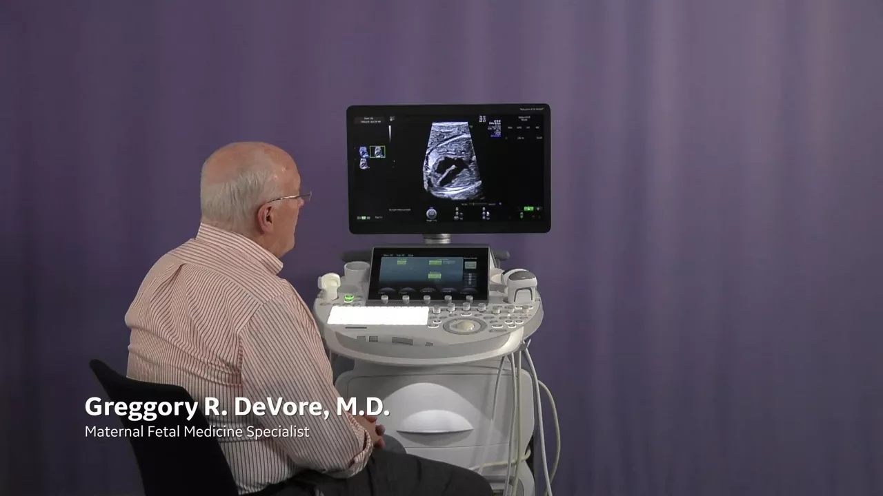 fetalhq-case-study-increased-left-ventricle