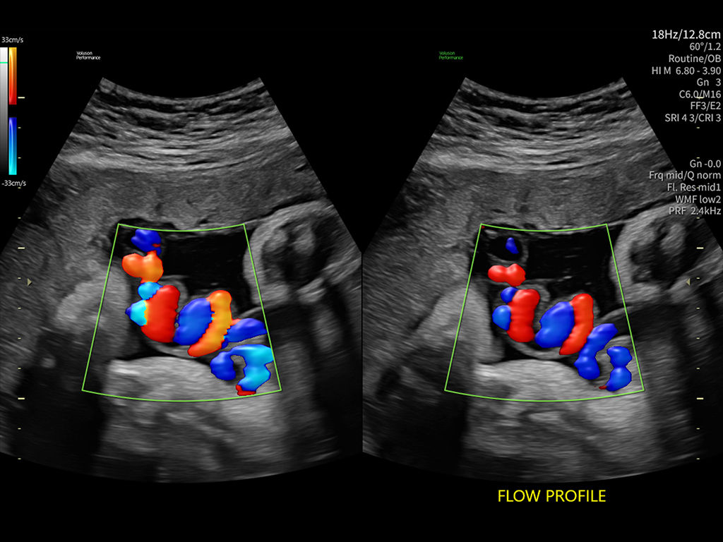 flow-profiles-tb