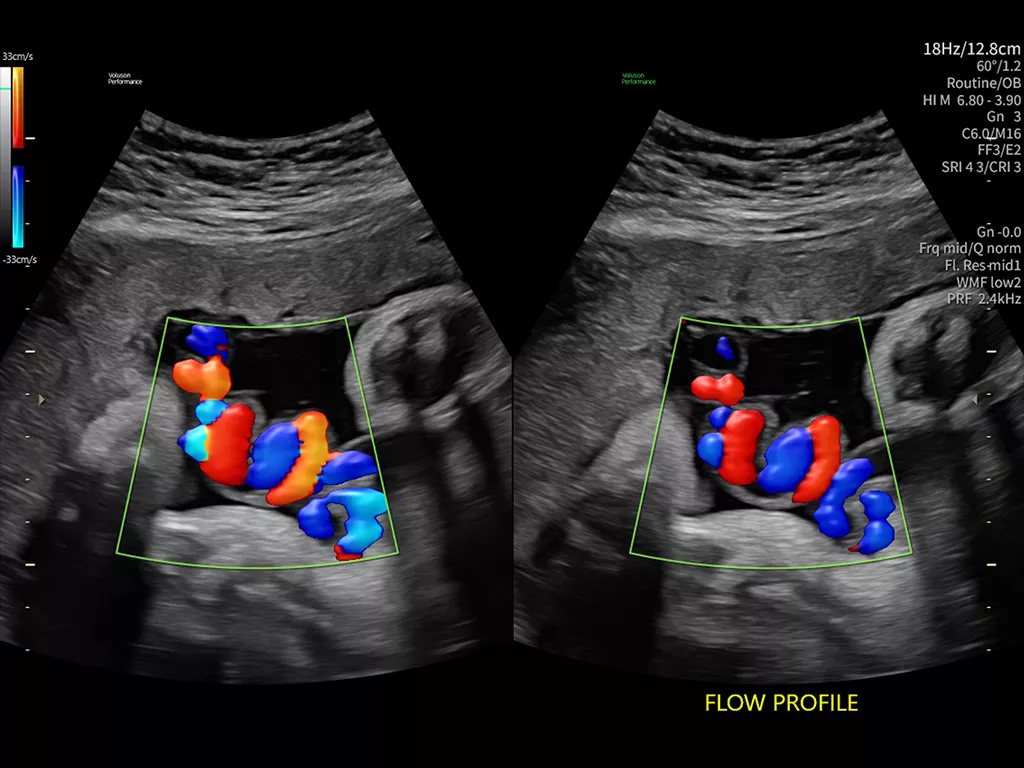 flow-profiles-tb