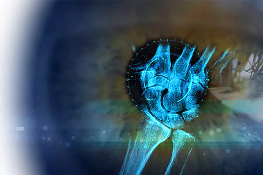 fluoroscopy-dynamic-graphics-