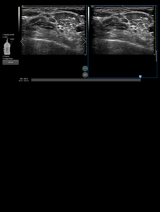 Follow-up-Nerves-desktop