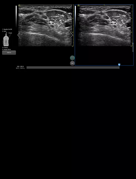 Follow-up-Nerves-desktop