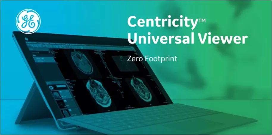 Footprint video