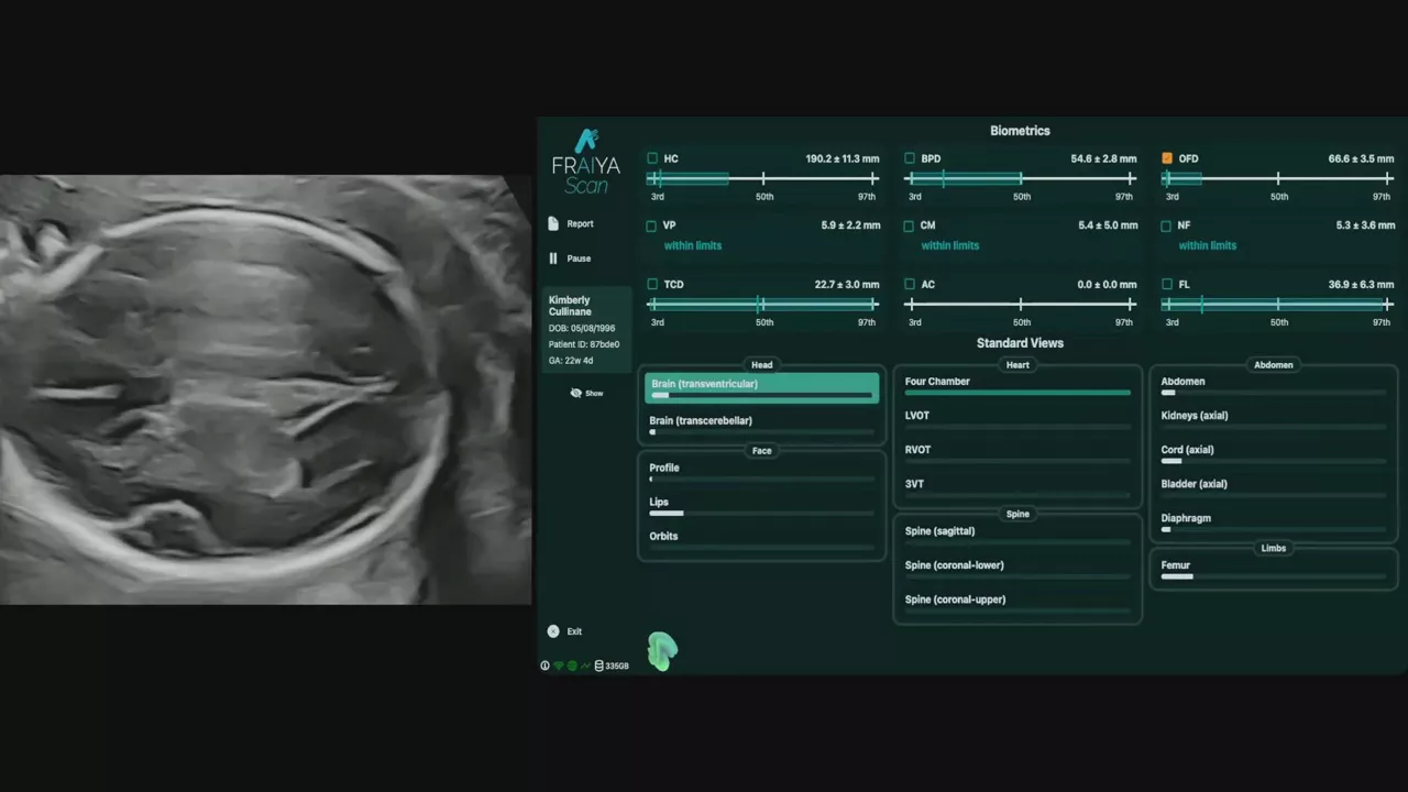 fraiyascan-related-content-tutorial-video1