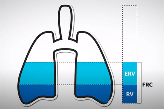 FRC-PEEP-LPV-ICU-THMB_560x373_web_arc_global