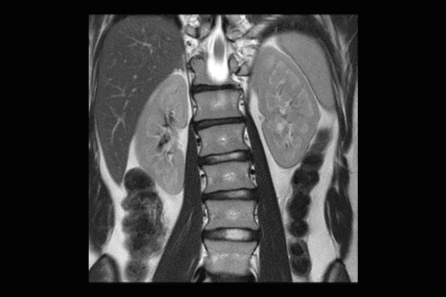 Free-breathing abdomen