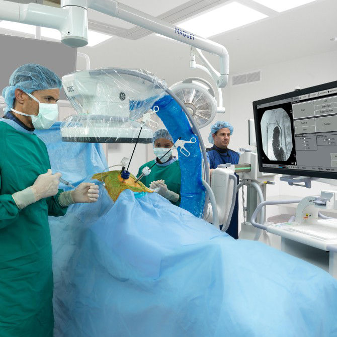 c-arms-for-gastrointestinal-surgery
