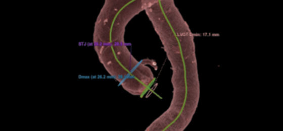 Gated axial b 560x260