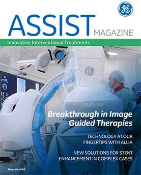 GE-ASSIST N10_FINAL img