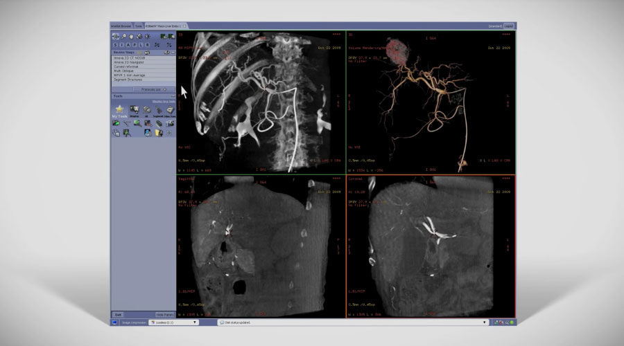 GE-AW-Innova-Vision-Radiology-Imaging-Software-Video