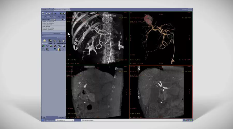 GE-AW-Innova-Vision-Radiology-Imaging-Software-Video