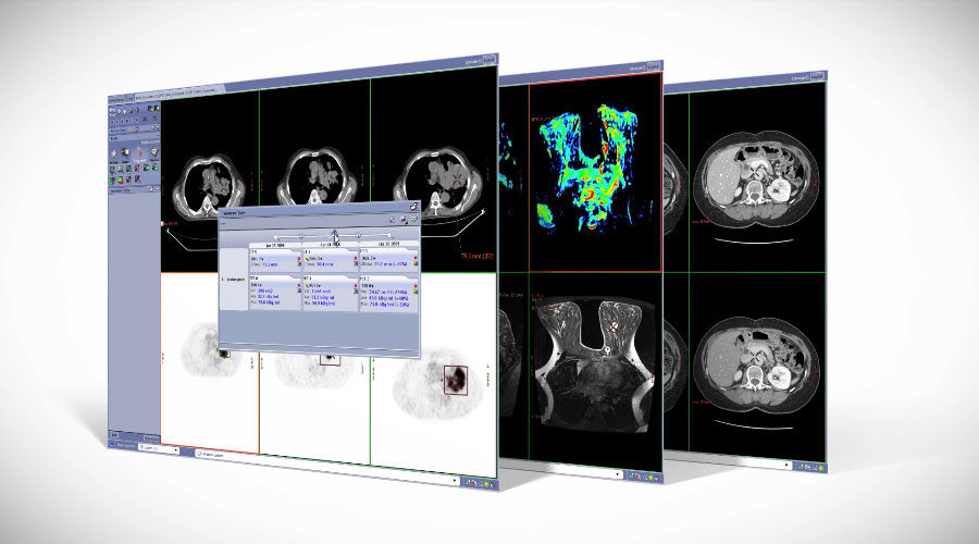 GE-AW-OncoQuant-Radiology-Imaging-Software-Video