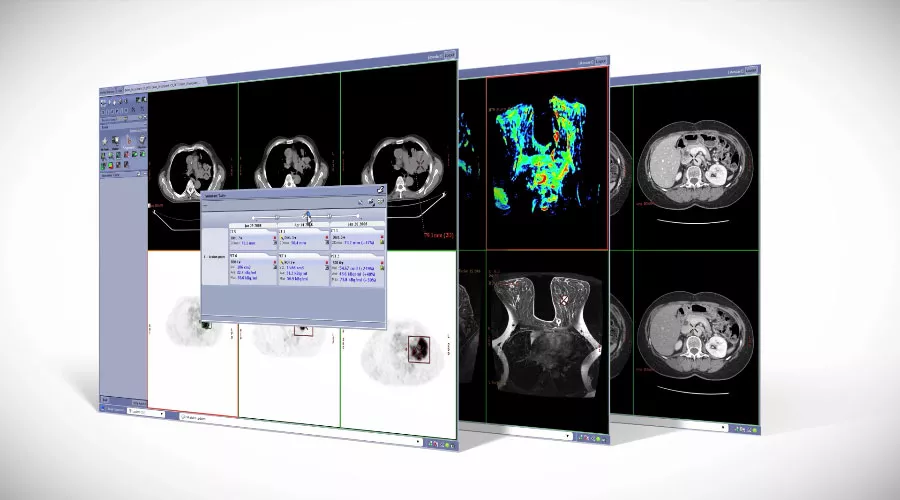 GE-AW-OncoQuant-Radiology-Imaging-Software-Video