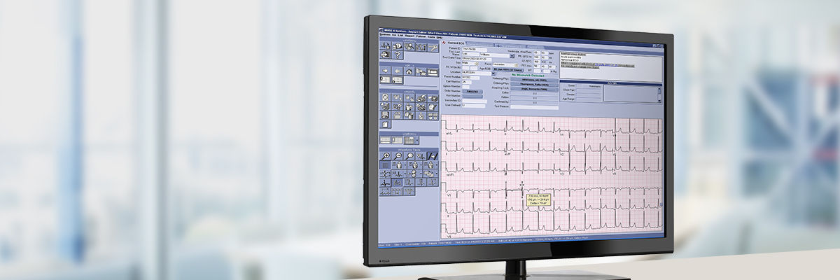 cardio data