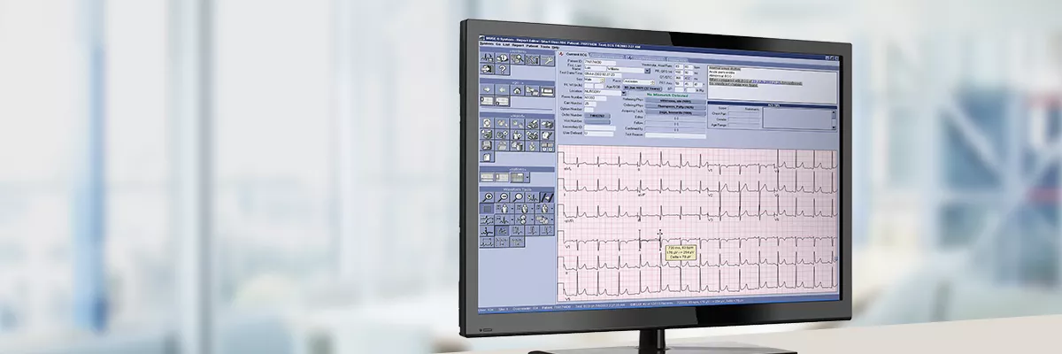 cardio data