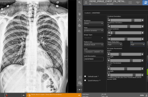Advanced Image Processing 2