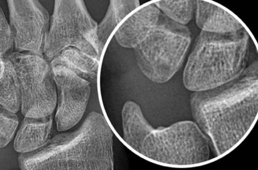 Advanced Image Processing