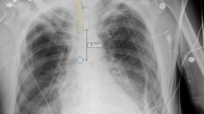 Advance Clinical Outcomes and Support Radiology Staff with Intelligent X-ray Efficiencies