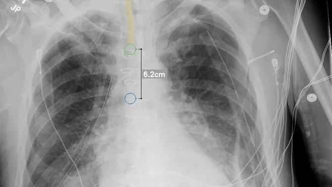 Advance Clinical Outcomes and Support Radiology Staff with Intelligent X-ray Efficiencies