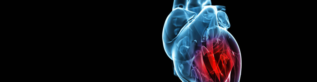 GE Healthcare Cardiology Solutions