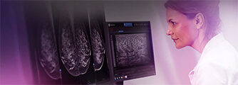 ge-seno-iris-mammography
