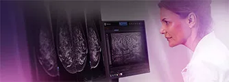 ge-seno-iris-mammography