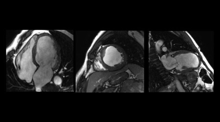 ge-product-categories-ultrasound-signa architect-clinical images-cvworks-CV Works1final.jpg