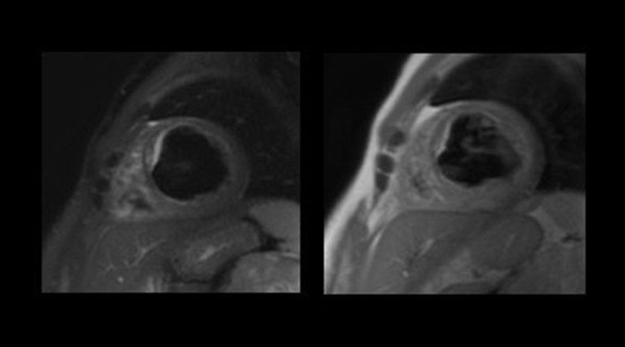 ge-product-categories-ultrasound-signa architect-clinical images-cvworks-CV Works2final.jpg