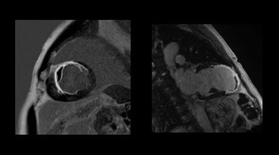ge-product-categories-ultrasound-signa architect-clinical images-cvworks-CV Works3final.jpg