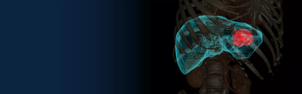 GE_RSNA_ImagingBanner_notext_2_1920x600