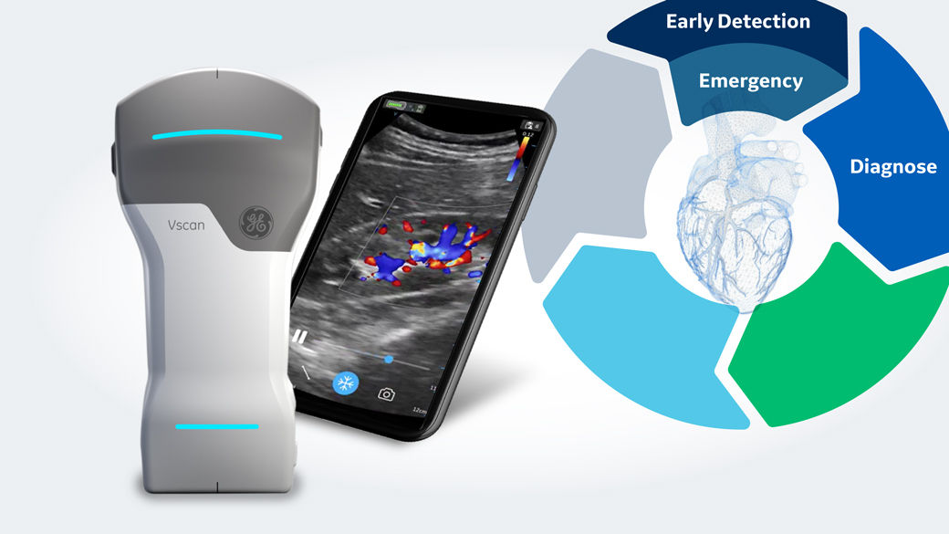 GE Handheld ultrasound