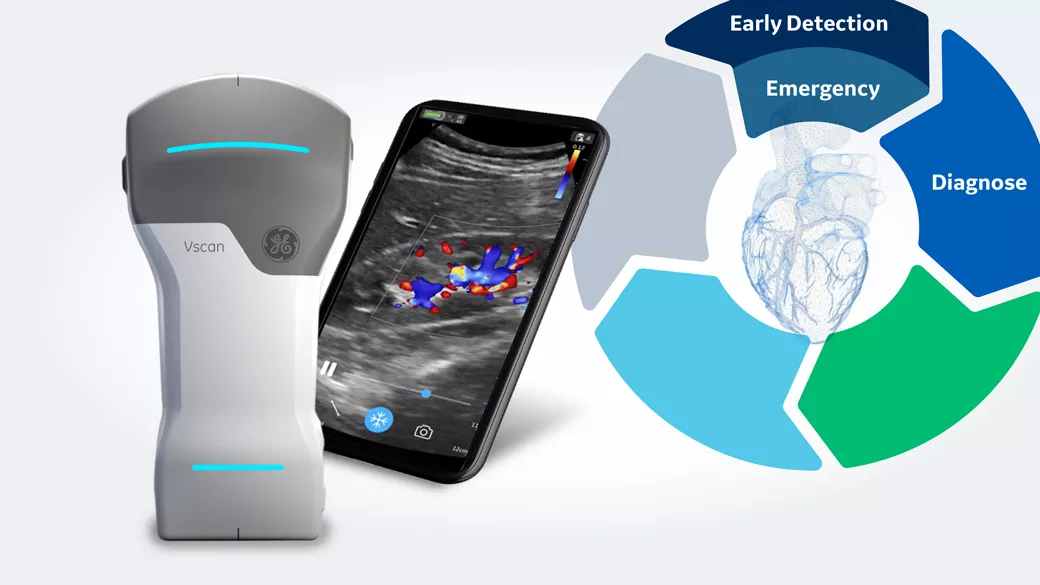 GE Handheld ultrasound