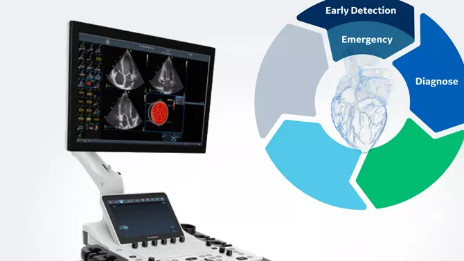 GE Cardiovascular Ultrasound