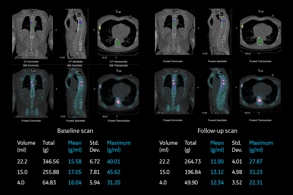 GEHC 870 DR Quantitation Image 2 v1