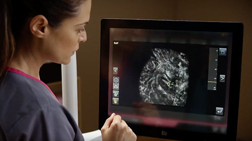 ABUS Patient exam video