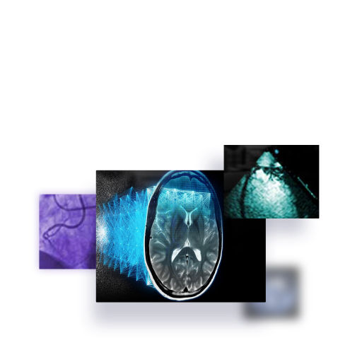 gehc-hp-pf04-PIA-DTM