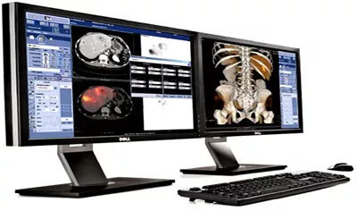 GEHC-Nuclear-Medicine-Xeleris_3_Dosimetry_Toolkit