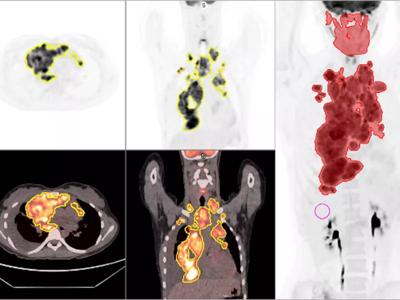 Precise quantitation clinical scan