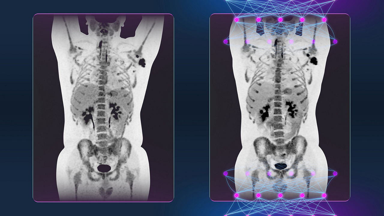 content card image