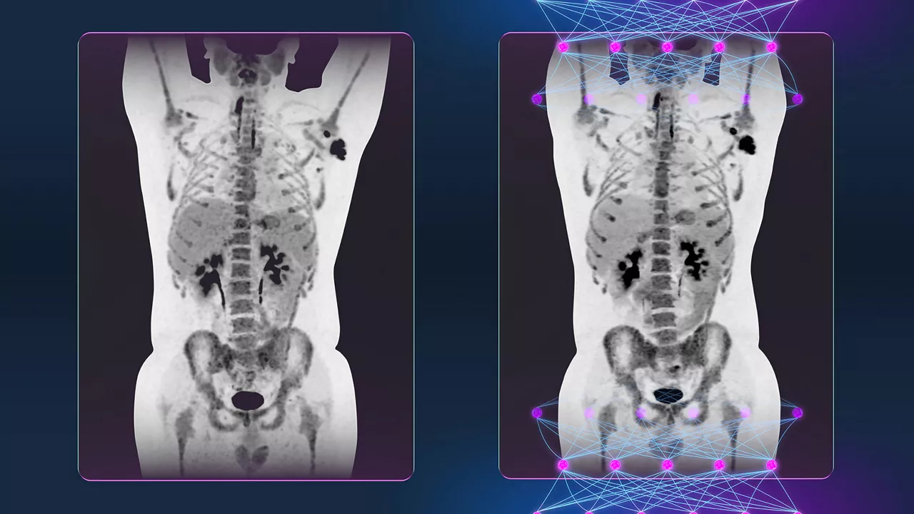 content card image