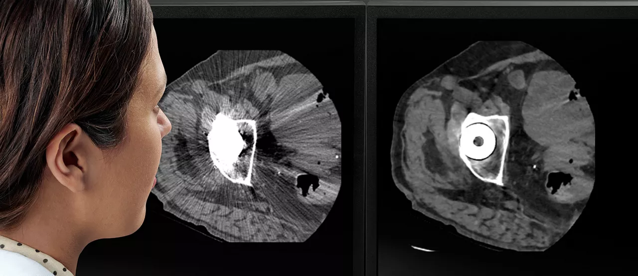 Radiologist reading clinical images