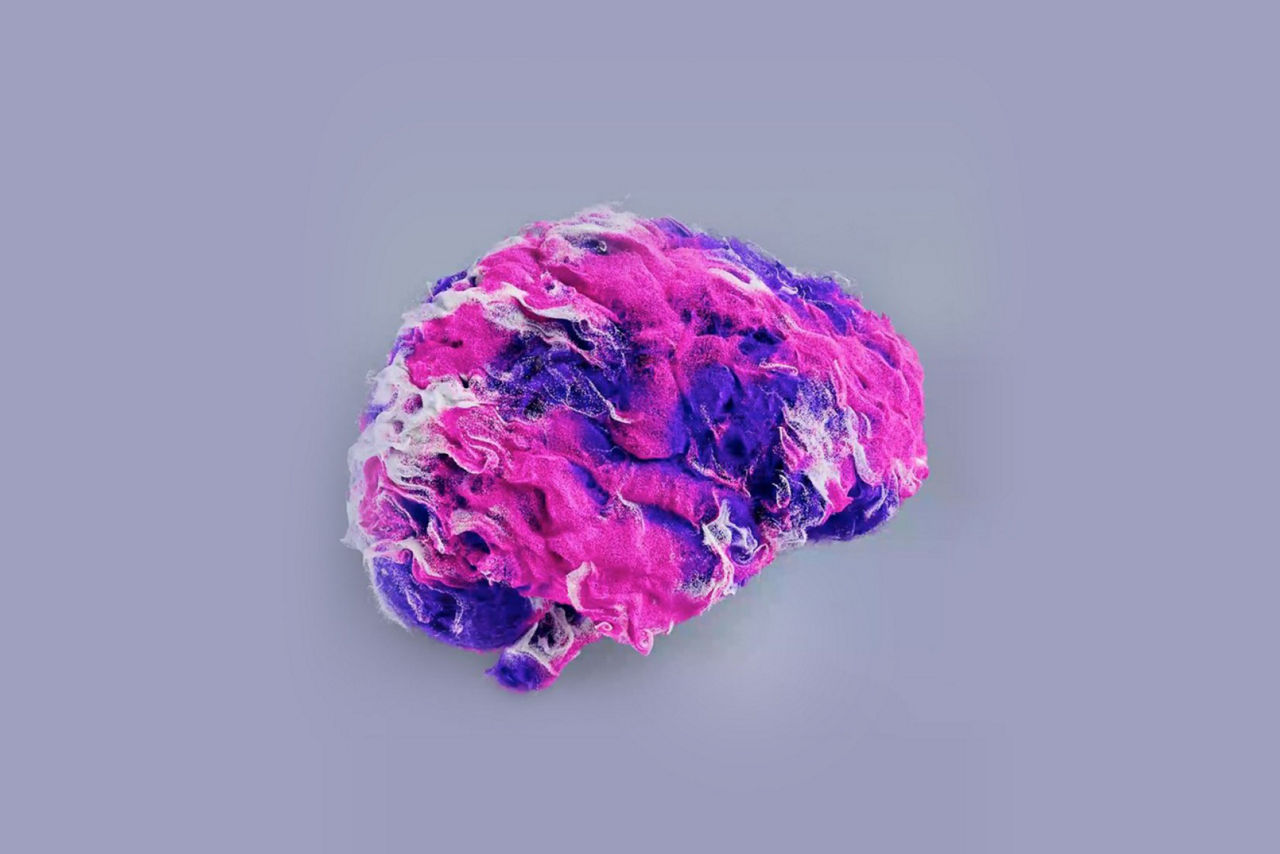 GEHC-SIGNA-victor-capabilities-PWP-Features-2