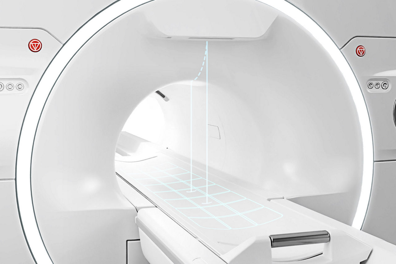 GEHC SIGNA Victor PWP Features 4 V3