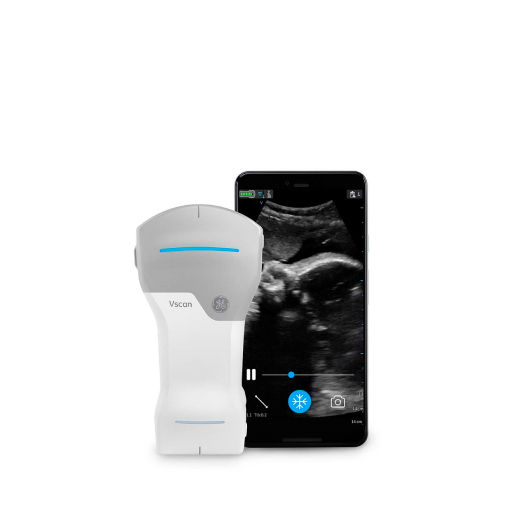 Handheld ultrasound scanner with scan on smartphone