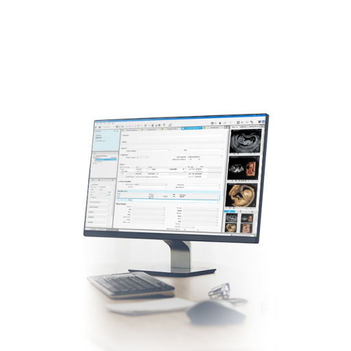 Computer keyboard and monitor showcasing scans